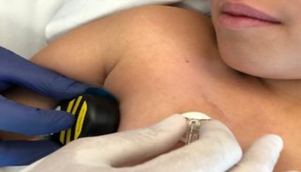 Load image into Gallery viewer, BTH1 - Buzzy® XL Healthcare Striped